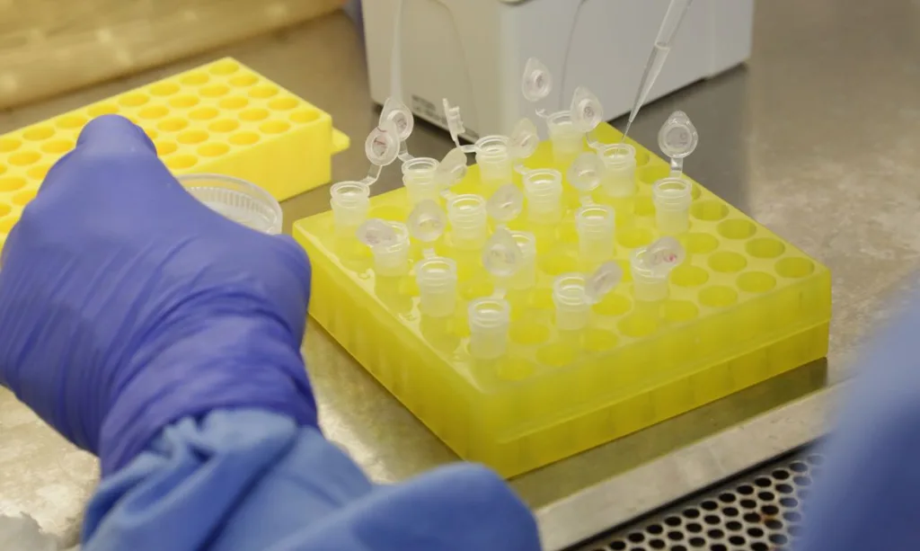 Vacina contra coronavírus de Oxford mostra resultados positivos na 1° fase