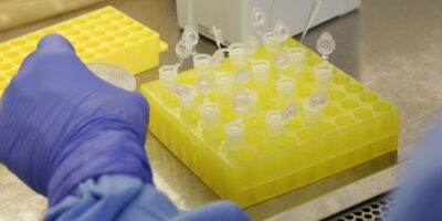 Itaú (ITUB4), Bradesco e Santander doam 5 milhões de testes de coronavírus