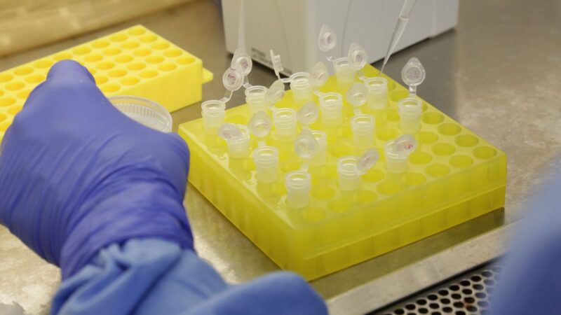 Itaú (ITUB4), Bradesco e Santander doam 5 milhões de testes de coronavírus