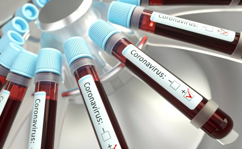 Após desconfiança dos cientistas, vacina de Oxford terá novos testes