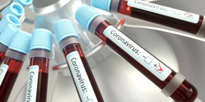 Coronavírus: farmacêutica entra em fase final de testes para anticorpos