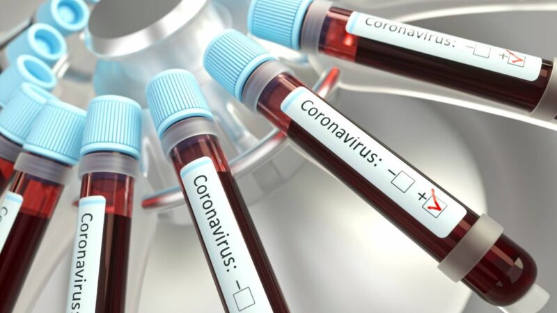 Coronavírus: farmacêutica entra em fase final de testes para anticorpos