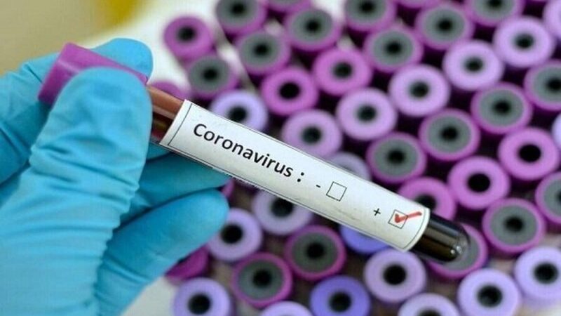 Mundo terá de viver com coronavírus “para sempre”, diz CEO da Moderna