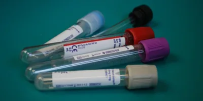 B3 aprova migração da Dasa (DASA3) para Novo Mercado